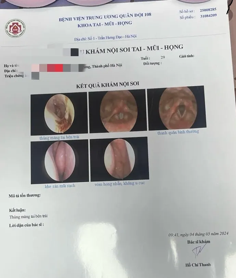 Một nữ du khách 'tố' bị đánh thủng màng nhĩ khi du lịch Ninh Thuận- Ảnh 4. Kết quả chẩn đoán nữ du khách bị thủng màng nhĩ trái - Ảnh: Nhân vật đăng trên Facebook