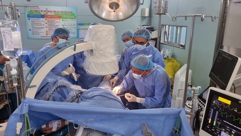 Lấy sỏi thận phức tạp gây đau đớn 20 năm cho người bệnh- Ảnh 1. PGS.TS.BS Nguyễn Phúc Cẩm Hoàng và các bác sĩ đang thực hiện kỹ thuật mới để lấy sạch sỏi cho bệnh nhân - Ảnh: Bệnh viện cung cấp