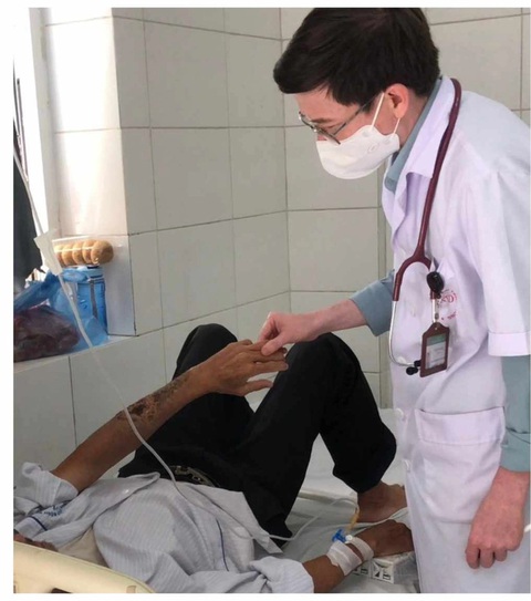 Cánh tay bệnh nhân lở loét khi tự dùng thuốc sau khi bị mèo cào - Ảnh: Bệnh viện cung cấp Cánh tay bệnh nhân lở loét do tự dùng thuốc điều trị sau khi bị mèo cào - Ảnh: Bệnh viện cung cấp