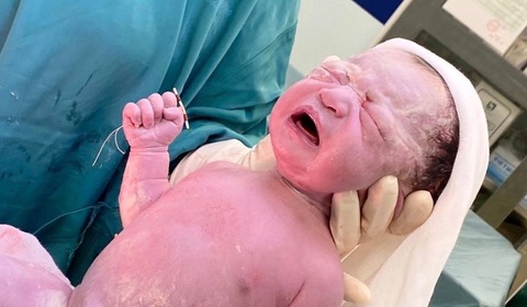 Bé sơ sinh được sinh ra cùng với vòng tránh thai của mẹ - Ảnh: Bệnh viện cung cấp Bé sơ sinh được sinh ra cùng với vòng tránh thai của mẹ - Ảnh: Bệnh viện cung cấp