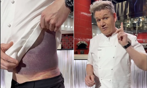 Gordon Ramsay nói may mắn còn sống sau vụ tai nạn xe đạp ở Mỹ- Ảnh 1. Đầu bếp Gordon Ramsay nói về tình trạng của mình sau tai nạn xe đạp nghiêm trọng ở Mỹ trong video vừa đăng tải trên trang cá nhân - Ảnh: Gordon Ramsey / Instagram