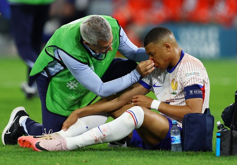 Tuyển Pháp nín thở trước chấn thương kinh hoàng của Mbappe- Ảnh 1. Mbappe gặp chấn thương mũi nặng trong chiến thắng của tuyển Pháp - Ảnh: REUTERS