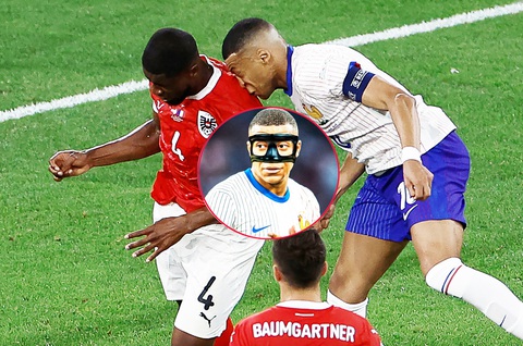 Ngôi sao tuyển Pháp Mbappe đã biết đùa trở lại- Ảnh 1. Tiền đạo tuyển Pháp Kylian Mbappe sẽ đeo mặt nạ thi đấu Euro 2024