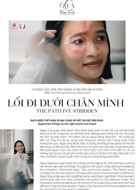 Nụ cười trở lại trên môi bệnh nhân bạch biến- Ảnh 5. Câu chuyện của chị Lê Ngọc Ửng thuộc dự án