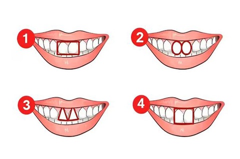 Quiz: Khám phá tính cách tiềm ẩn qua hình dạng răng cửa của bạn- Ảnh 1. Quiz: Khám phá tính cách tiềm ẩn qua hình dạng răng cửa của bạn- Ảnh 1.