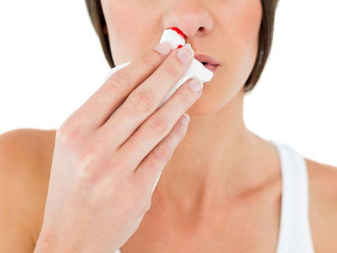 Chảy máu cam: Bác sĩ chỉ cách xử trí đúng, tránh nguy hiểm- Ảnh 1. Chảy máu cam (chảy máu mũi) do nắng nóng rất thường gặp trong mùa hè - Ảnh minh họa