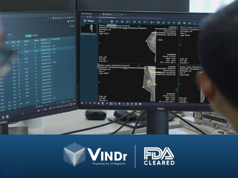 Sản phẩm AI của VinBigdata đạt chuẩn FDA, tiến vào thị trường Mỹ- Ảnh 1. VinDr trở thành sản phẩm AI cho chẩn đoán X-quang tuyến vú đầu tiên và duy nhất tại Việt Nam được FDA công nhận. Ảnh: Đ.H
