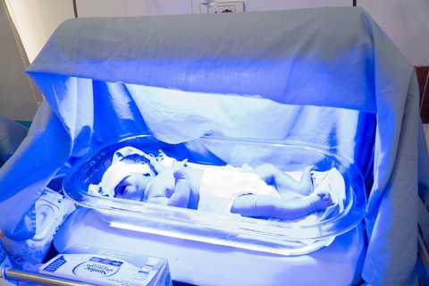 Trẻ sơ sinh bị vàng da cần được chú ý chăm sóc cực sớm- Ảnh 2. Chiếu đèn điều trị vàng da - Ảnh: BVCC