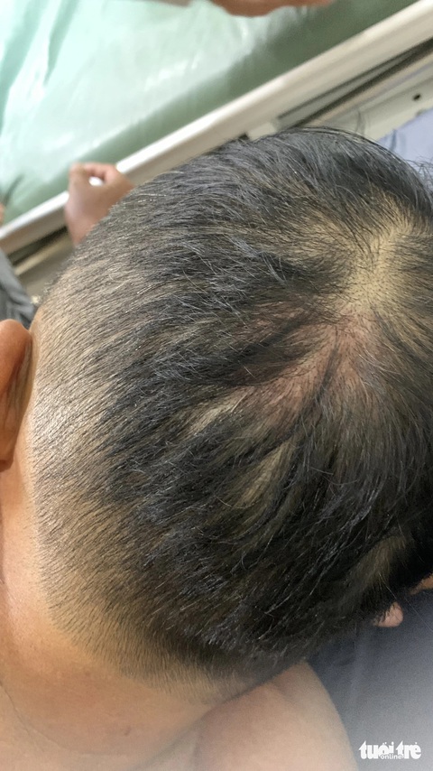 Nạn nhân bị đánh thương tích 74%, công an thừa nhận chưa điều tra được vì thiếu nhân chứng- Ảnh 1. Con gái ông Danh Cường tố hàng xóm đánh cha ruột bị dập sọ não, tổn thương 74% nhưng công an chưa bắt được hung thủ - Ảnh: NNCC