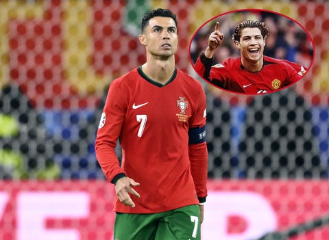 Cristiano Ronaldo dính nghi vấn phẫu thuật thẩm mỹ- Ảnh 1. Cristiano Ronaldo dính nghi vấn phẫu thuật thẩm mỹ