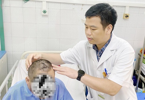 Cứu sống bệnh nhân tự đóng cây đinh dài hơn 5cm vào sọ- Ảnh 1. Bác sĩ Bệnh viện Đa khoa tỉnh Thanh Hóa kiểm tra vết phẫu thuật trên đầu bệnh nhân L.Q.T. trước khi xuất viện - Ảnh bệnh viện cung cấp