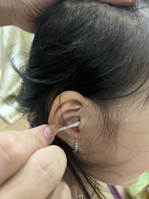 Có nên làm sạch, lấy ráy tai cho trẻ mỗi ngày?- Ảnh 1. Việc lấy ráy tai, làm sạch tai mỗi ngày là không cần thiết - Ảnh: TƯỜNG VY