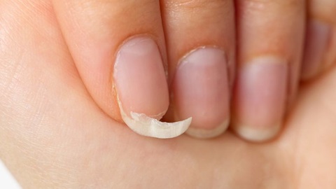 Dấu hiệu cơ thể 'kêu cứu' vì đang thiếu canxi- Ảnh 2. Móng tay yếu và dễ gãy cũng là biểu hiện của sự thiếu canxi trong cơ thể - Ảnh minh họa