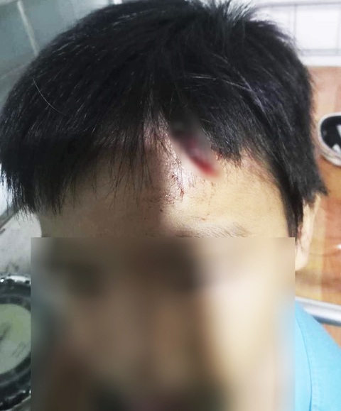 Khởi tố vụ án bé trai 10 tuổi nghi bị mẹ kế bạo hành ở Cà Mau- Ảnh 1. Bé T. trước đó đã bị bà N. hành hạ nhiều lần - Ảnh: THANH HUYỀN