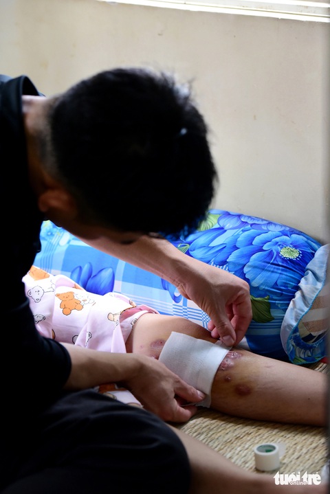 Vợ chồng trẻ cùng vượt qua nghịch cảnh- Ảnh 5. Vợ chồng trẻ cùng vượt qua nghịch cảnh- Ảnh 5.
