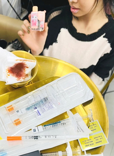 Một spa làm chui dịch vụ tiêm filler cằm cho khách hàng - Ảnh: T.T Một spa làm chui dịch vụ tiêm filler cằm cho khách hàng - Ảnh: T.T