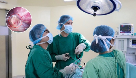 Cao huyết áp thứ phát do u tuyến thượng thận- Ảnh 1. Cao huyết áp thứ phát do u tuyến thượng thận- Ảnh 1.