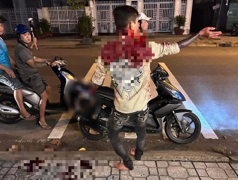 Chủ nợ chém con nợ đứt lìa bàn tay- Ảnh 1. B. bị Ty chém đứt lìa tay ngay ngoài đường - Ảnh: Người dân cung cấp