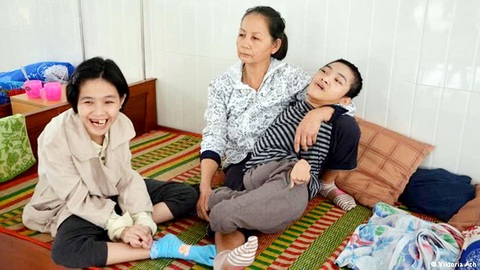 Người mẹ chăm sóc hai đứa con bị di chứng chất độc da cam ở Việt Nam - Ảnh: dw.com Người mẹ chăm sóc hai đứa con bị di chứng chất độc da cam ở Việt Nam - Ảnh: dw.com