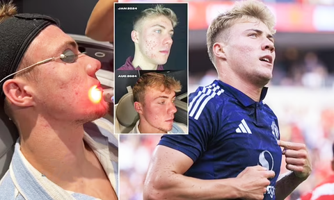 Rasmus Hojlund của Man Utd chi khủng để làm đẹp- Ảnh 1. Rasmus Hojlund đã chi nhiều tiền để cải thiện gương mặt bị mụn và sẹo rỗ - Ảnh: DAILYMAIL