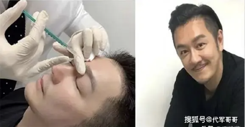 Trần Hạo Dân, Lưu Khải Uy và những sao nam đổi đời nhờ ‘đập đi xây lại'- Ảnh 8. Trần Hạo Dân chọn phương pháp tiêm chất làm đầy để níu giữ thanh xuân