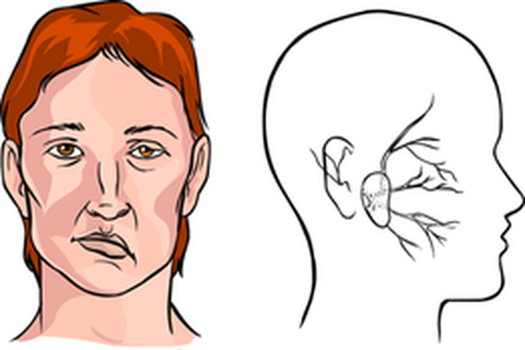 Cách loại bỏ thói quen gây đột quỵ chúng ta thường mắc mà không biết- Ảnh 3. Cách loại bỏ thói quen gây đột quỵ chúng ta thường mắc mà không biết- Ảnh 3.