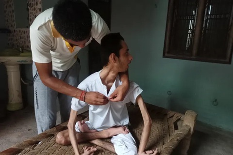 1/3 số dân một ngôi làng ở Ấn Độ mắc ung thư vì nguồn nước ô nhiễm- Ảnh 1. 1/3 số dân một ngôi làng ở Ấn Độ mắc ung thư vì nguồn nước ô nhiễm - Ảnh 1.