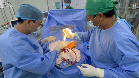 Phẫu thuật cho bé gái bị chiếc kéo đâm xuyên sọ- Ảnh 1. Ê kíp phẫu thuật lấy chiếc kéo ở đỉnh sọ nạn nhân - Ảnh: Bệnh viện cung cấp