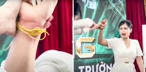 Bắn dây thun để…truyền cảm hứng: Bác sĩ bất ngờ vì hành động ‘dại dột’ - Ảnh 1. Bắn dây thun để… truyền cảm hứng: Bác sĩ bất ngờ vì hành động ‘dại dột’ - Ảnh 1.