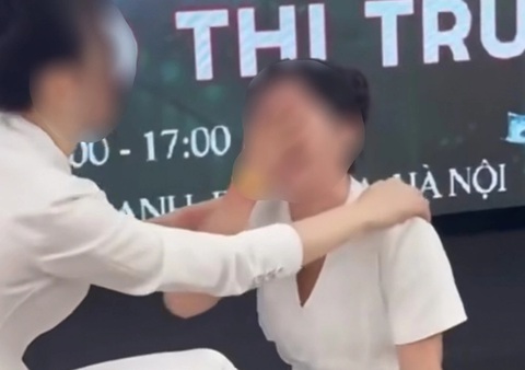 Bắn dây thun tay sưng đỏ lè đau đớn là truyền cảm hứng dữ chưa? - Ảnh 2.