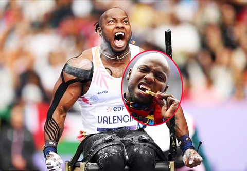 Nhà vô địch Paralympic 2024 gây chú ý với bộ răng ‘ma cà rồng’ - Ảnh 1.