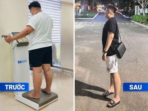 Người nước ngoài đến Việt Nam giảm cân, giảm mỡ - Ảnh 2.