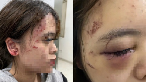 Buổi tối kinh hoàng của thiếu nữ 17 tuổi bị nhóm người đánh bầm dập, ép quỳ gối xin lỗi - Ảnh 1.