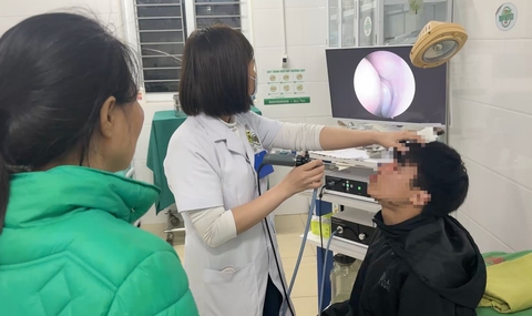 Phẫu thuật cho nam sinh bị đánh gãy mũi giữa đường - Ảnh 1.