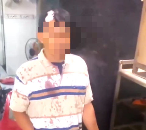 Xác minh clip người đàn ông tố bị tài xế Chi cục Thi hành án dân sự dùng mũ bảo hiểm đánh chảy máu - Ảnh 1. Xác minh clip người đàn ông tố đang ăn cơm thì bị 2 cha con xông vào đánh chảy máu - Ảnh 1.