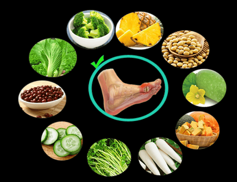 Bệnh gout dễ tái phát, lưu ý những dấu hiệu này để thăm khám sớm - Ảnh 2.