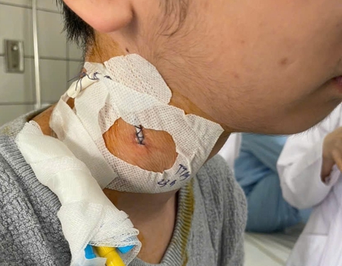 Bác sĩ ngán ngẩm vì ‘người bệnh tự gây bệnh’ - Ảnh 1. Bác sĩ ngán ngẩm vì ‘người bệnh tự gây bệnh’ - Ảnh 1.