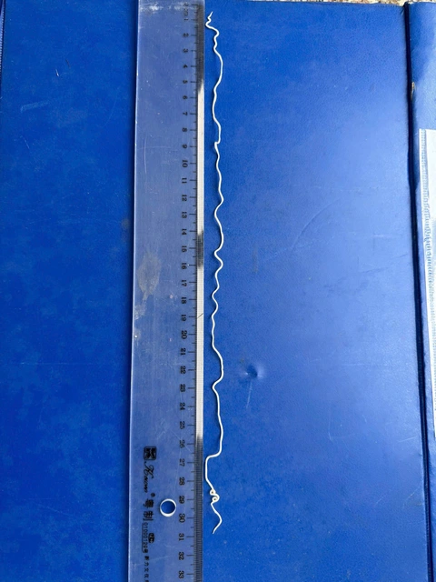 giun rồng - Ảnh 1.
