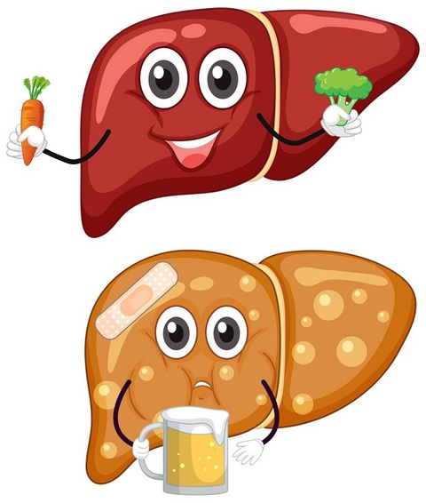 Gan nhiễm mỡ làm tăng nguy cơ ung thư, dấu hiệu nào nhận biết sớm? - Ảnh 1. gan nhiễm mỡ - Ảnh 1.