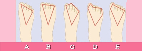 hình dạng bàn chân - Ảnh 1.