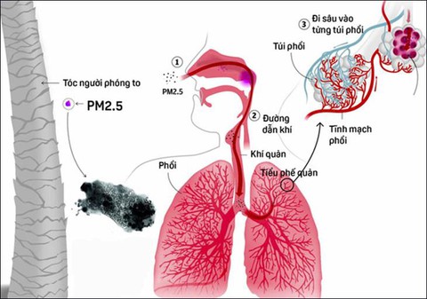 Tác hại của bụi mịn PM2.5 đến sức khỏe và cách bảo vệ - Ảnh 2.