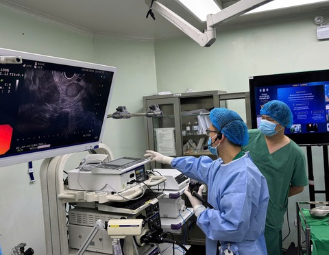 Sắp có Trung tâm Nội soi khu vực Đồng bằng sông Cửu Long - Ảnh 1.