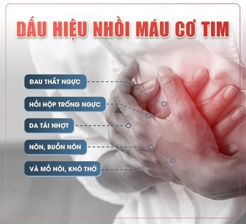 nhồi máu - Ảnh 2.