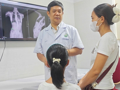 Nhiều trẻ gù vẹo cột sống phát hiện muộn - Ảnh 1. Nhiều trẻ gù vẹo cột sống phát hiện muộn - Ảnh 1.