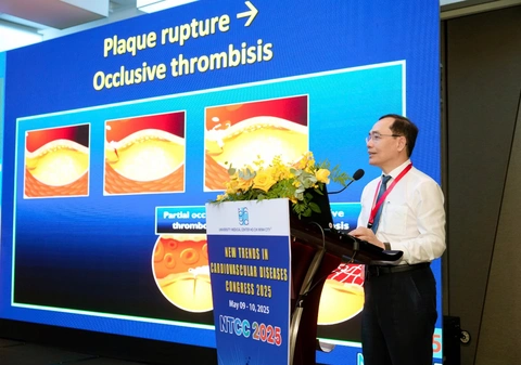tim mạch - Ảnh 4.