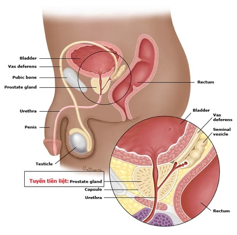 Ông Biden bị ung thư tuyến tiền liệt: Loại ung thư dễ di căn đến xương - Ảnh 1. Joe Biden - Ảnh 1.