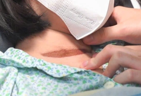 cửa cuốn - Ảnh 1.
