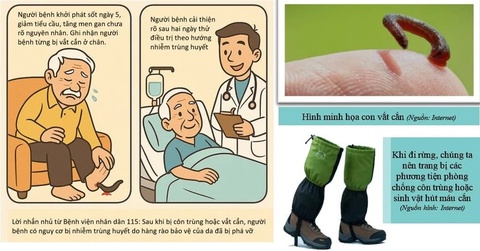 vắt cắn - Ảnh 1.