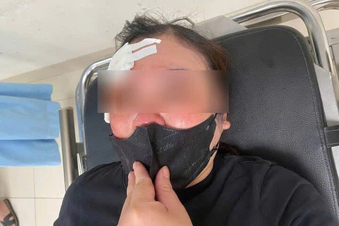 Tài xế bán tải đánh dùi cui vào đầu người đang dừng xe nghe điện thoại - Ảnh 1.