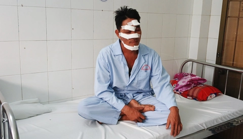 Máy bay nông nghiệp chém trúng đầu người chạy xe máy - Ảnh 1.